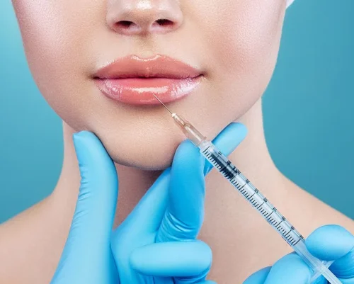 Lip Enhancement6webp